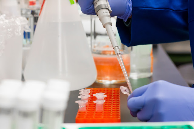 Commonly done medical lab tests and their normal values