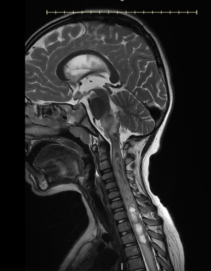 When an “Interesting Case” Becomes a Lifelong Lesson